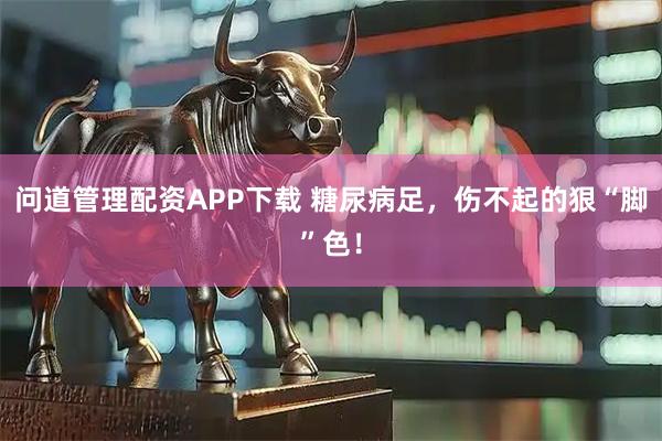 问道管理配资APP下载 糖尿病足，伤不起的狠“脚”色！